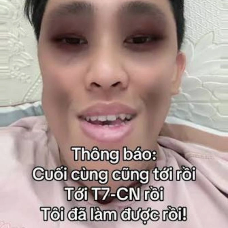 Gương mặt Mai Trí Thức đờ đẫn, mắt thâm quầng
